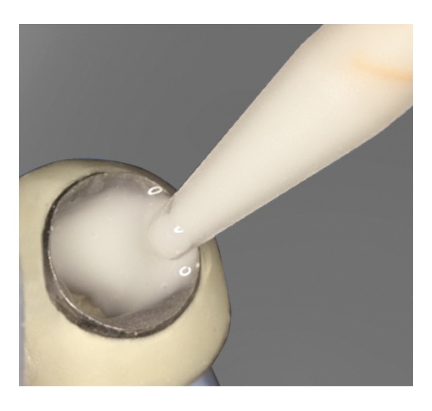 implantlink-semi-classic-einfuellen-a
