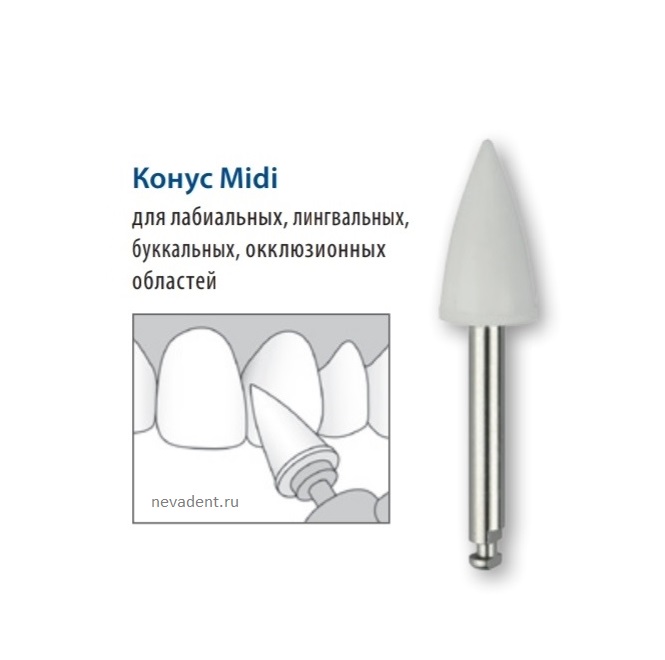 Полиры силиконовые OneGloss (форма конус) 50шт (без держателя) SHOFU Полиры силиконовые ВанГлосс /OneGloss IC (форма Конус Midi) для любых композитных реставраций, 50шт (без держателя) SHOFU